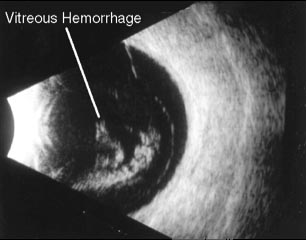  Ultrasound imaging